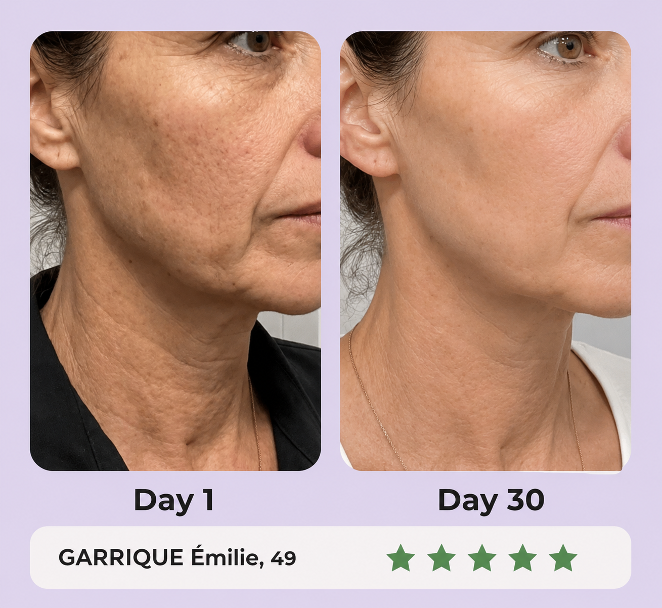 Gua Sha LED Anti-Rides — 7 Modes Professionnels