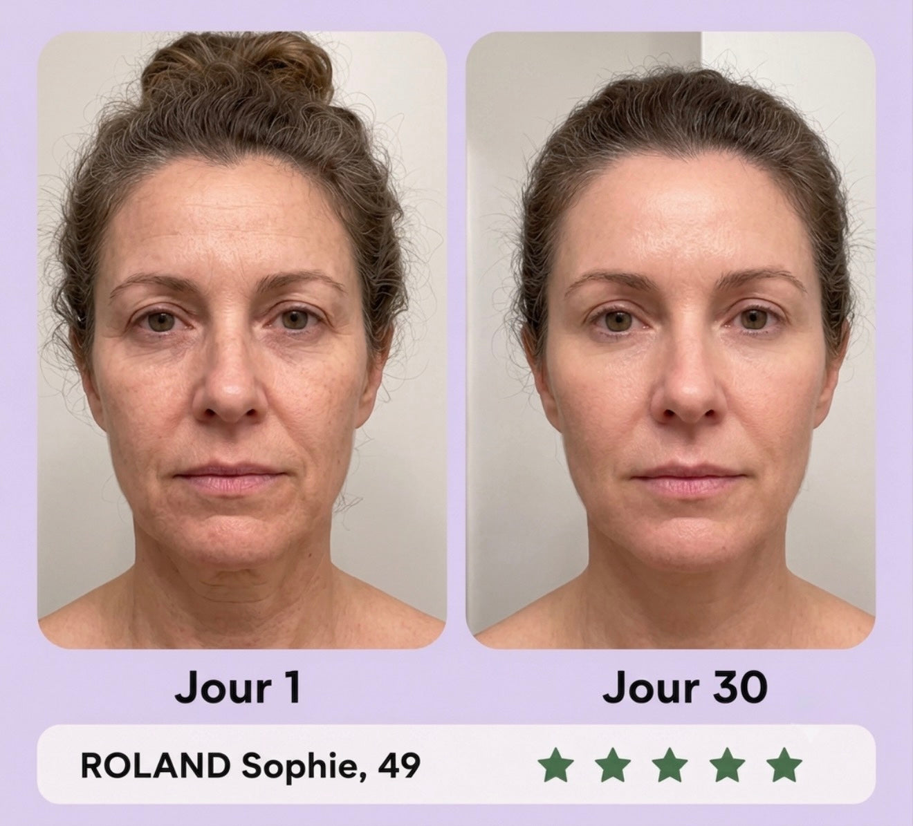 Gua Sha LED Anti-Rides — 7 Modes Professionnels