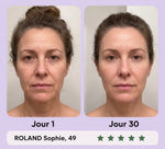 Gua Sha LED Anti-Rides — 7 Modes Professionnels image 7