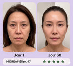 Gua Sha LED Anti-Rides — 7 Modes Professionnels image 8