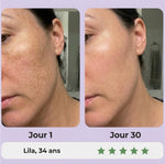 Gua Sha LED Anti-Rides — 7 Modes Professionnels image 6
