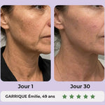 Gua Sha LED Anti-Rides — 7 Modes Professionnels image 5