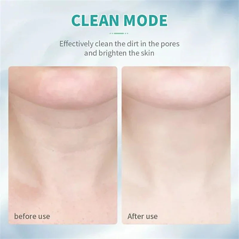 Rejuvenate Your Skin with the 7 Modes Neck and Face Lift Beauty Device – Achieve a Firm, Youthful Glow!
